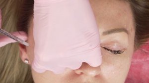 Биоревитализация. Препараты и техника работы