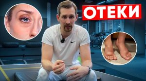 Отеки: почему они появляются и как их убрать? Причины, последствия, эффективные техники