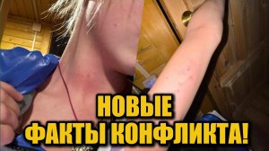 Жесткий конфликт в фигурном катании: новые заявления Рудковской