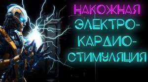 Накожная электрокардиостимуляция. Как стимуляция выполняется и что делать. #ПроСМП