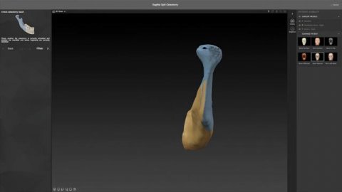 Рабочий процесс 5 - Создание виртуальных остеотомий _ IPS CaseDesigner® Руководство