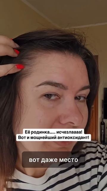 Пропала большая родинка со лба после приема Неорезерво