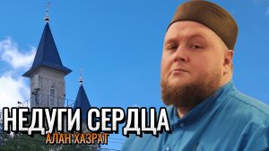 Чрезмерность в общении | Алан хазрат