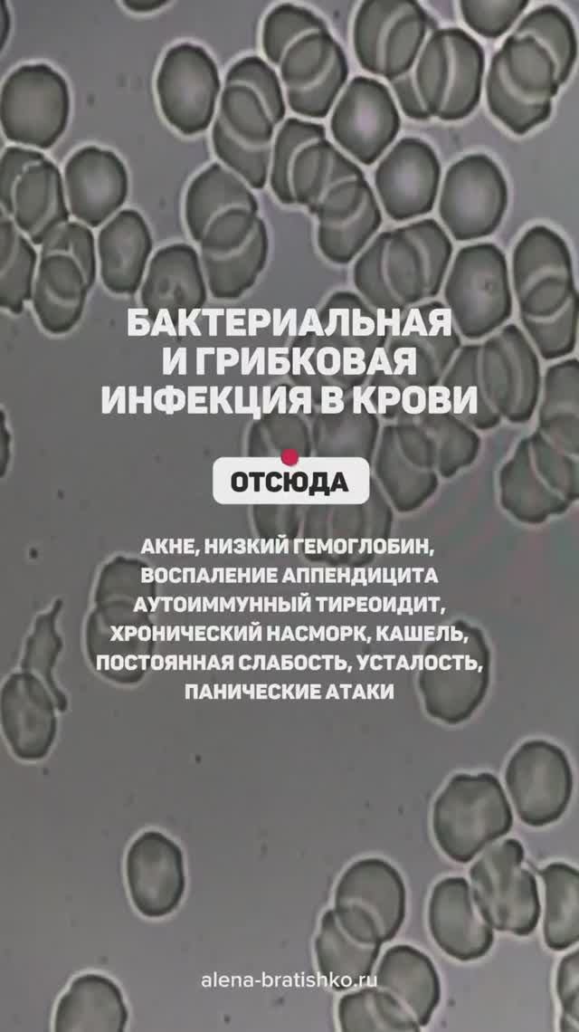 Бактериальная и грибковая инфекция в крови. Откуда акне, аутоиммунный тиреоидит, слабость, усталость