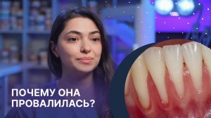 Рецессия десны: что делать, если опустилась десна?