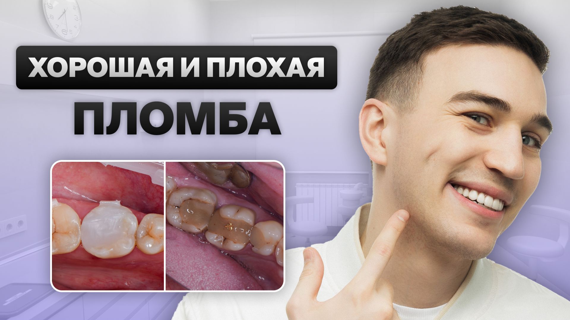 Хорошая и плохая пломба