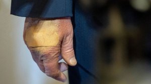 Трамп вышел к журналистам с пластырем на запястье