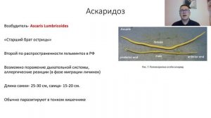 Гельминтозы (энтеробиоз, аскаридоз,описторхоз, трихинеллез). Лекция для студента и врача.
