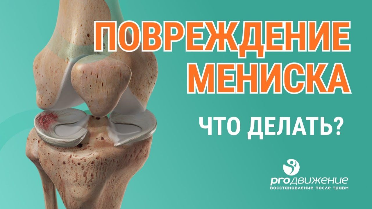 🩺🦵 Повреждение мениска: диагностика и лечение
