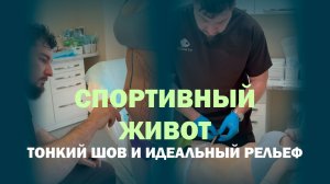 Липоабдоминопластика у Абозина: новый рельеф и новый пупок