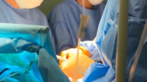 Кардиохирурги впервые вылечили всех детей с аномалией Эбштейна в Казахстане