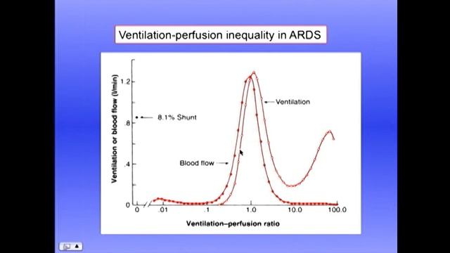 7 West дыхательная недостаточность (Respiratory Failure)