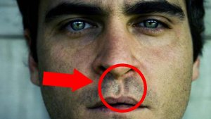 И ещё один Топ 6 самых страшных дефектов знаменитостей