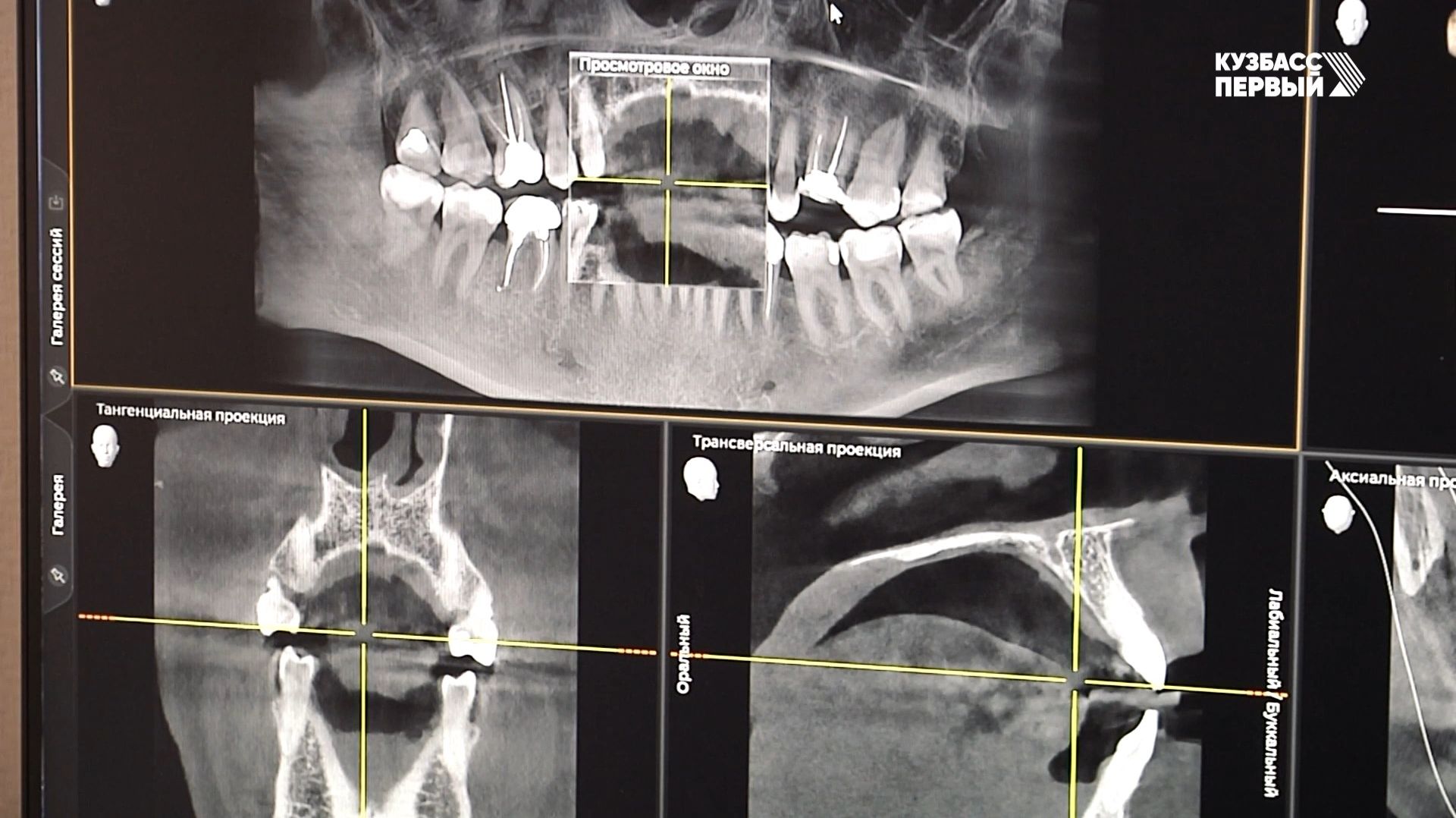 Здоровая улыбка России. Чем обычное лечение отличается от лечения под микроскопом?