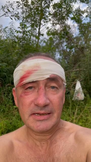 Всем прикладом!!! Хряпнулся через руль с горы #rattleribelk