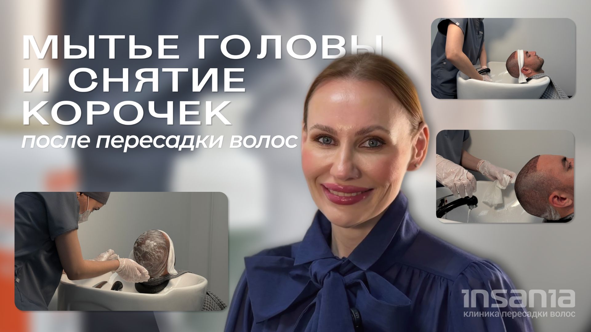 Мытье головы и снятие корочек после пересадки волос смотреть онлайн