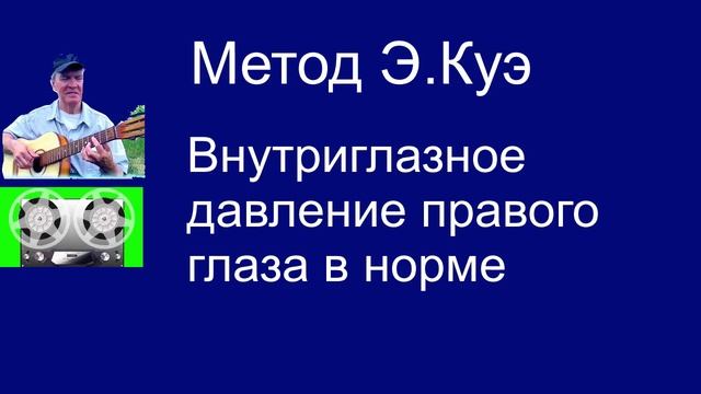 Внутриглазное давление моего правого глаза в норме