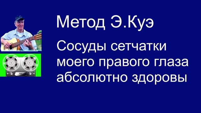 Сосуды сетчатки моего правого глаза абсолютно здоровы