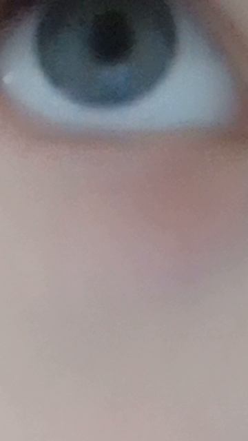 как двигается глаз смотреть онлайн