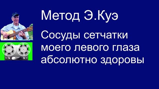 Сосуды сетчатки моего левого глаза абсолютно здоровы