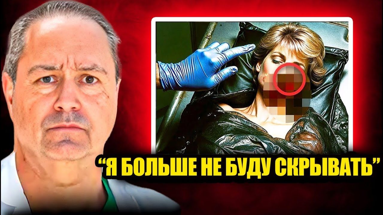 Хирург пытавшийся спасти принцессу Диану нарушил молчание и шокировал весь мир!