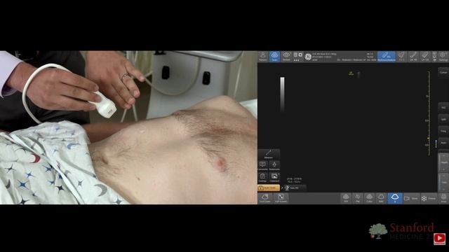 10 Point of Care Ultrasound of the Gallbladder RU