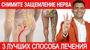 ВЫЛЕЧИТЕ БОЛЬ ОТ ИШИАСА ЕСТЕСТВЕННЫМ ПУТЁМ - 3 СРЕДСТВА + 3 ПИТАТЕЛЬНЫХ ВЕЩЕСТВА