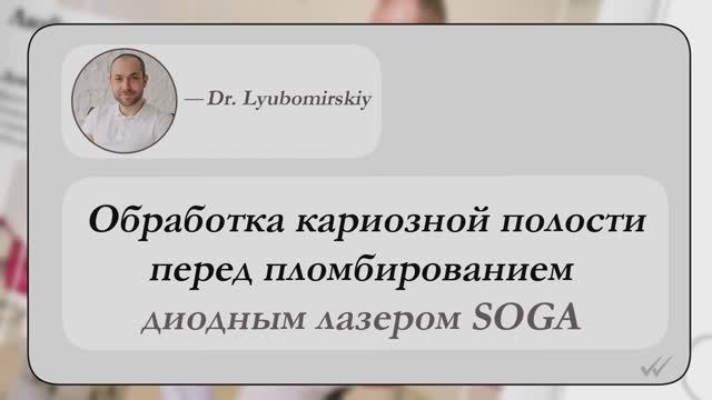 Обработка кариозной полости перед пломбированием диодным лазером SOGA с Геннадием Любомирским
