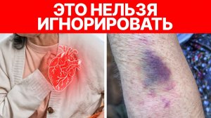 8 самых ОПАСНЫХ симптомов скорого ИНФАРКТА! / Что нужно сделать каждому прямо сейчас?