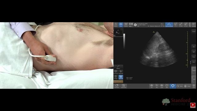 8 Point of Care Kidney and Bladder Ultrasound Stanford RU
