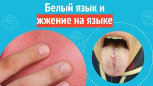 👅 Белый язык и жжение на языке. Клинический случай №1657