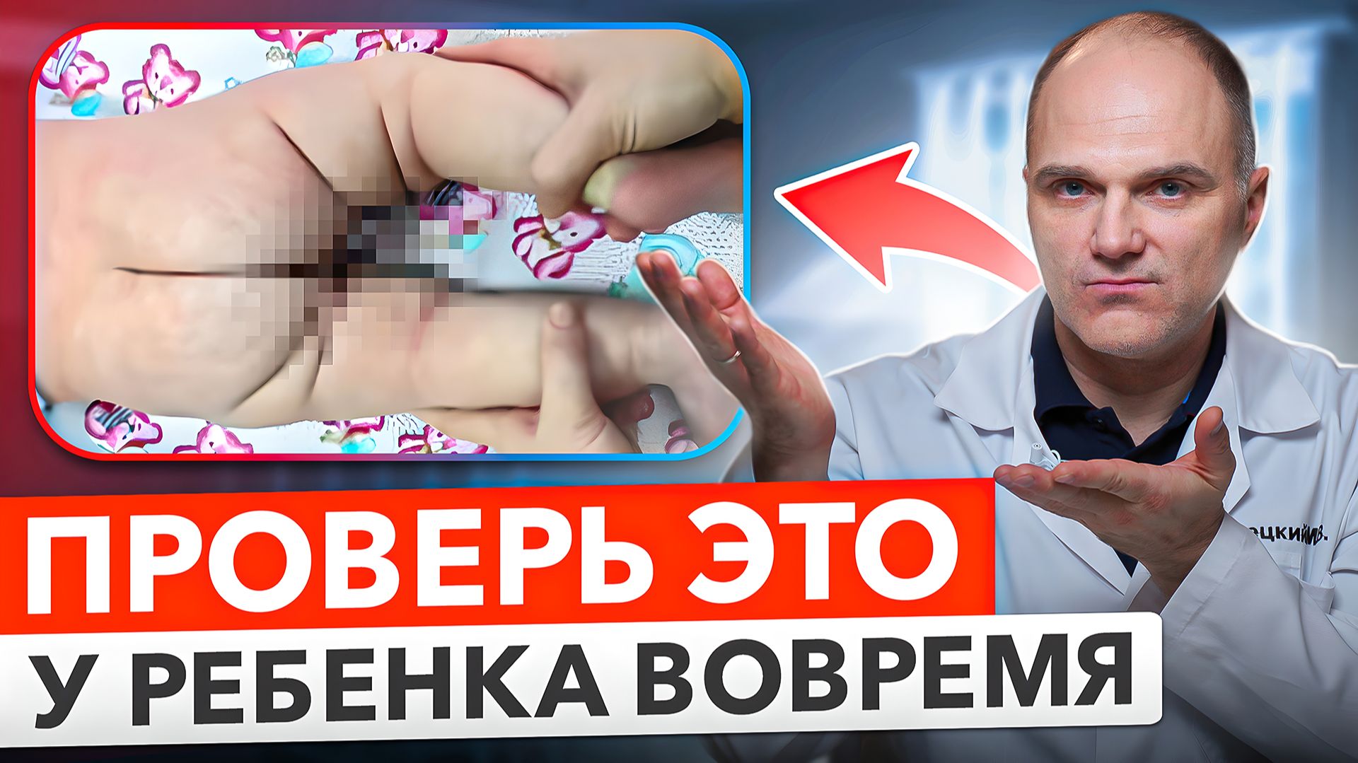 Как легко распознать дисплазию у ребенка: Скрытые признаки на ранней стадии