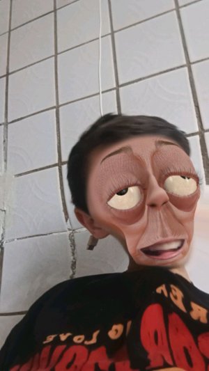 Стримчатский лежу в больничке