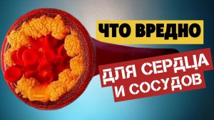 Продукты повышающие холестерин в крови у женщин и мужчин. Самая вредная еда в мире, Топ-5