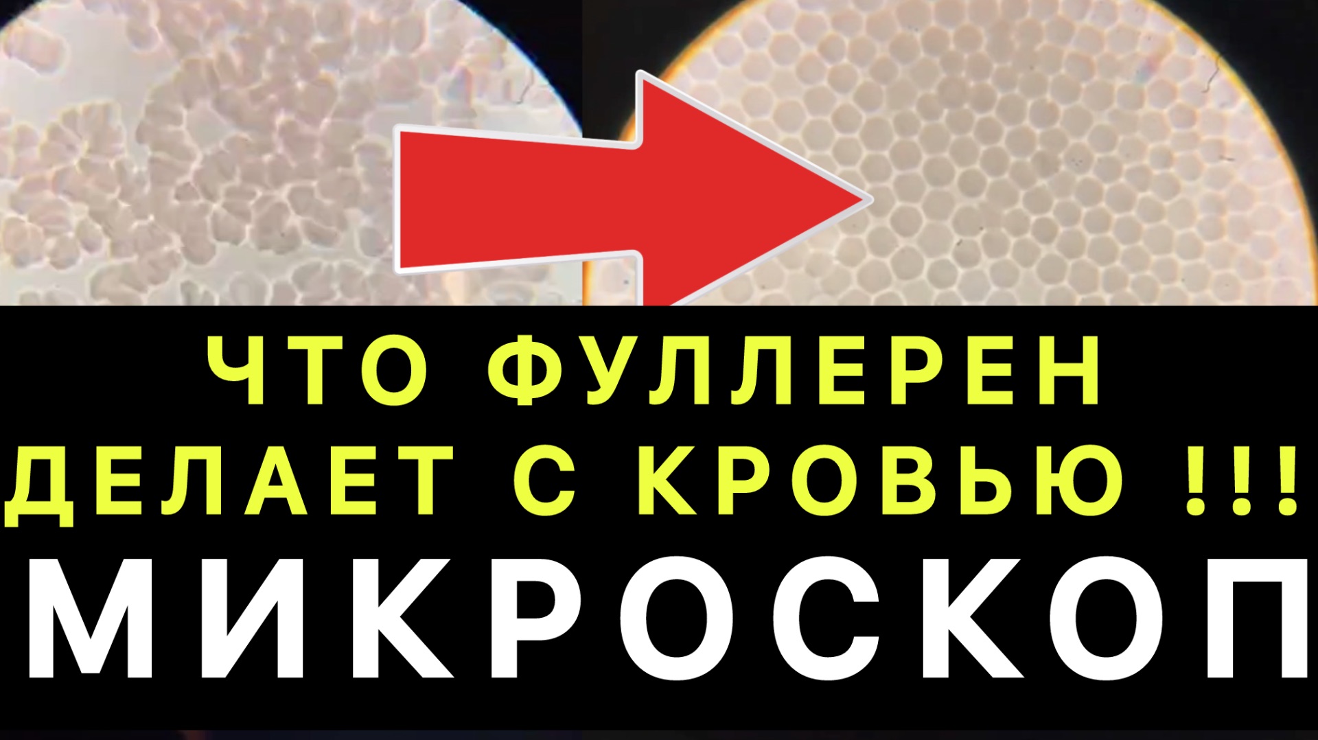 ❗️ЧТО ФУЛЛЕРЕН ДЕЛАЕТ С КРОВЬЮ / МИКРОСКОП