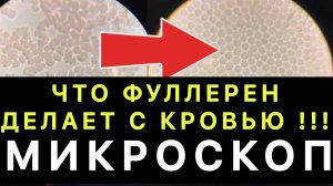 ❗️ЧТО ФУЛЛЕРЕН ДЕЛАЕТ С КРОВЬЮ / МИКРОСКОП