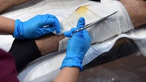 Житель Торского рассказал о попытке вытащить осколок из ноги после атаки ВСУ