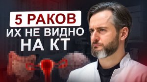 КТ всего тела: 5 видов рака, которых не видно. Как тогда искать? Врач объясняет