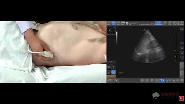 8 Point of Care Kidney and Bladder Ultrasound Stanford