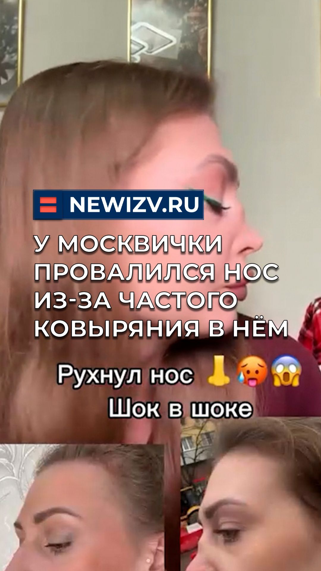 У москвички провалился нос из-за частого ковыряния в нём смотреть онлайн