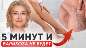 Чтобы НЕ БЫЛО ВАРИКОЗА: делайте этот комплекс каждый день