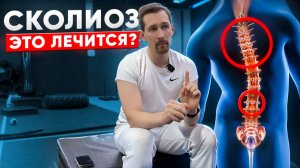Сколиоз: ВСЯ ПРАВДА о спине! Можно ли ИСПРАВИТЬ в любом возрасте?