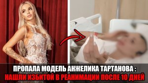Две недели в реанимации: пропавшую модель Анжелику Тартанову нашли избитой в тяжелом состоянии