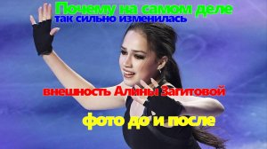 Почему на самом деле так сильно изменилась внешность Алины Загитовой: фото до и после