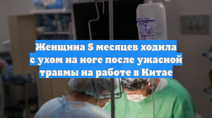 Женщина 5 месяцев ходила с ухом на ноге после ужасной травмы на работе в Китае