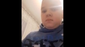 я спалил лицо