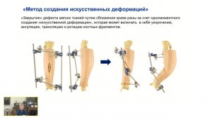 Искусственные деформации.