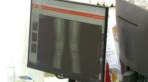 (Рыбинск-40) ДЕТСКИЙ ТРАВМАТИЗМ