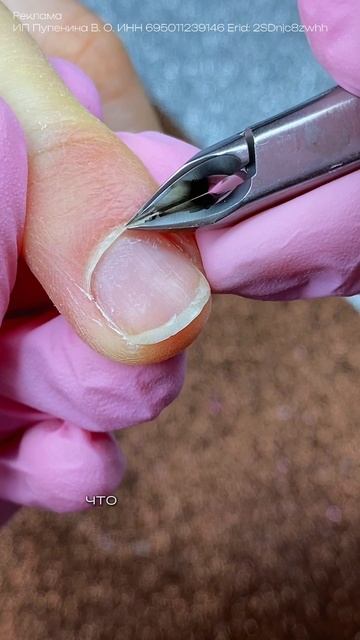 Обработка налипшей стелющейся кутикулы 😬 со склейками в синусе у вас были такие клиенты? смотреть онлайн