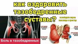 Зажатые ягодичные нервы вредят тазобедренным суставам и пояснице. Упражнения для нервов крестца